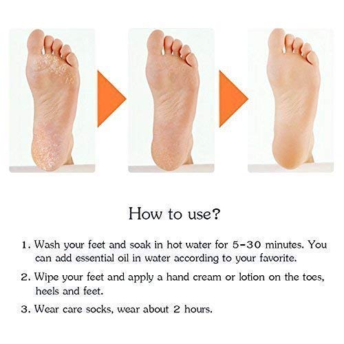 Anti Crack Full Length Silicone Foot Protector - Mart4U