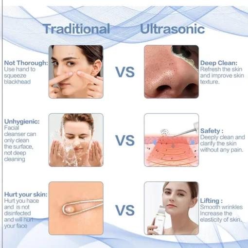 Ultrasonic Facial Skin Scrubber - Mart4U